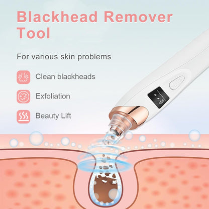 2026 Blackhead Vacuum, Pore Vacuum,Rechargeable Black Head Remover for Face | 3 Adjustable Suction Levels, 5 Replaceable Heads, Blackhead Spatula for Women & Men, Blackhead Remover Vacuum for Deep Clean