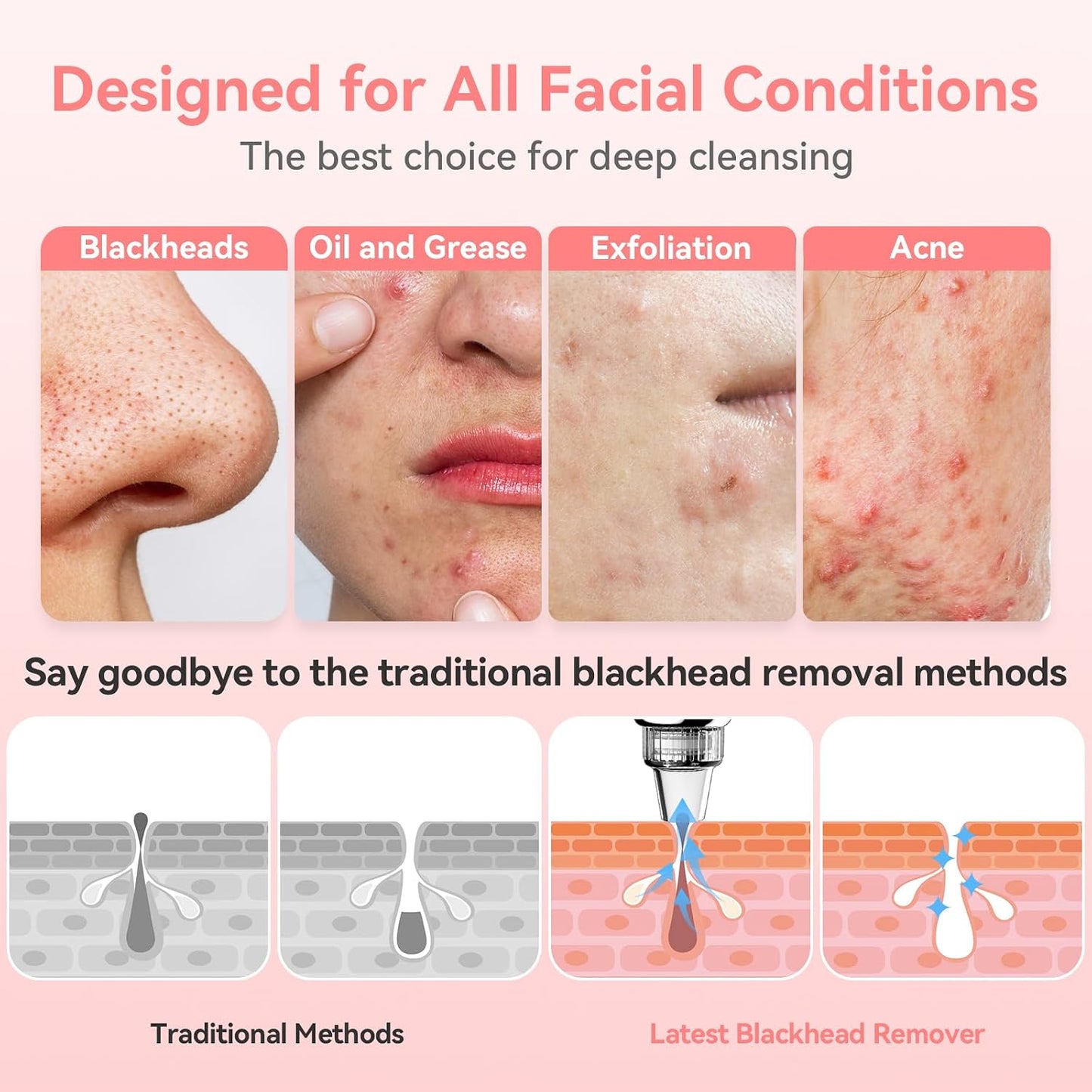 Blackhead Remover Pore Vacuum, USB Rechargeable Face Pore Cleaner Tool | Upgraded Electric Comedone Whitehead Extractor Tool-5 Suction Power,5 Probes,Blackhead Vacuum Kit for Women & Men