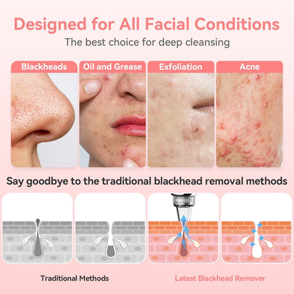 Blackhead Remover Pore Vacuum, USB Rechargeable Face Pore Cleaner Tool | Upgraded Electric Comedone Whitehead Extractor Tool-5 Suction Power,5 Probes,Blackhead Vacuum Kit for Women & Men